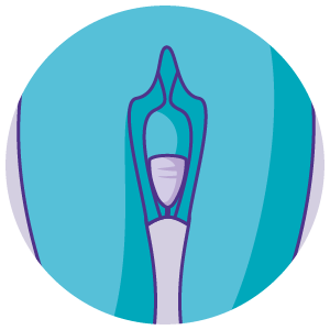 for insertion and removal trimming the stem of the menstrual cup is important